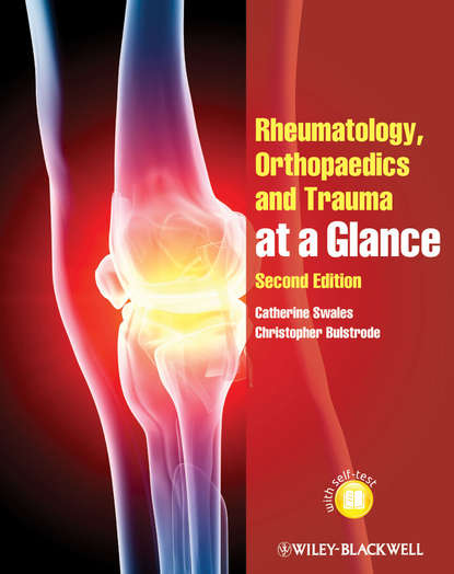 Скачать книгу Rheumatology, Orthopaedics and Trauma at a Glance