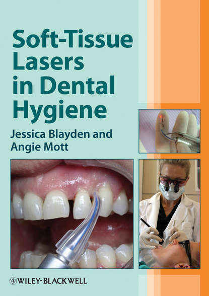 Скачать книгу Soft-Tissue Lasers in Dental Hygiene