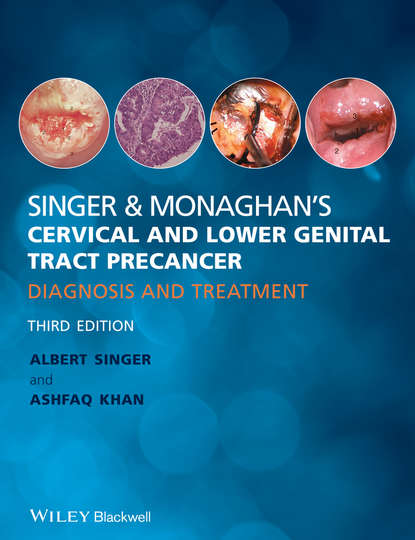 Скачать книгу Singer & Monaghan's Cervical and Lower Genital Tract Precancer. Diagnosis and Treatment