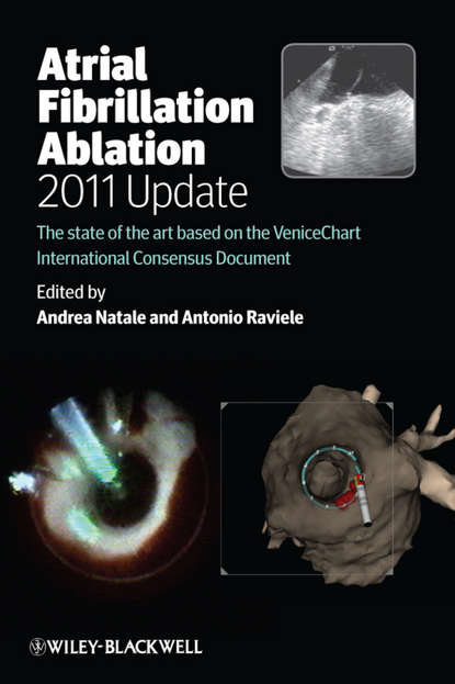 Скачать книгу Atrial Fibrillation Ablation, 2011 Update. The State of the Art based on the VeniceChart International Consensus Document