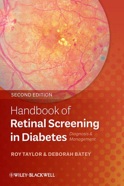 Скачать книгу Handbook of Retinal Screening in Diabetes. Diagnosis and Management