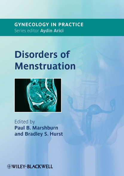 Скачать книгу Disorders of Menstruation