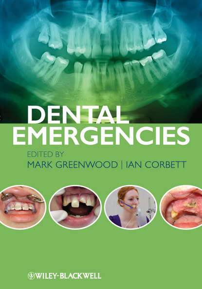 Скачать книгу Dental Emergencies