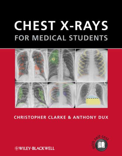 Скачать книгу Chest X-rays for Medical Students