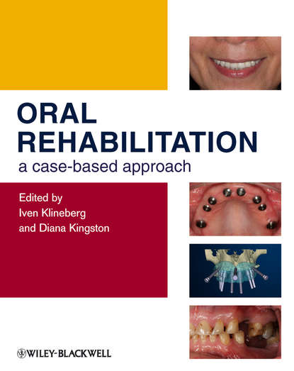 Скачать книгу Oral Rehabilitation. A Case-Based Approach