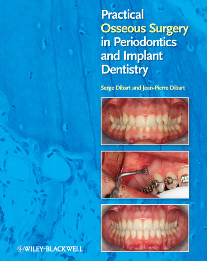 Скачать книгу Practical Osseous Surgery in Periodontics and Implant Dentistry