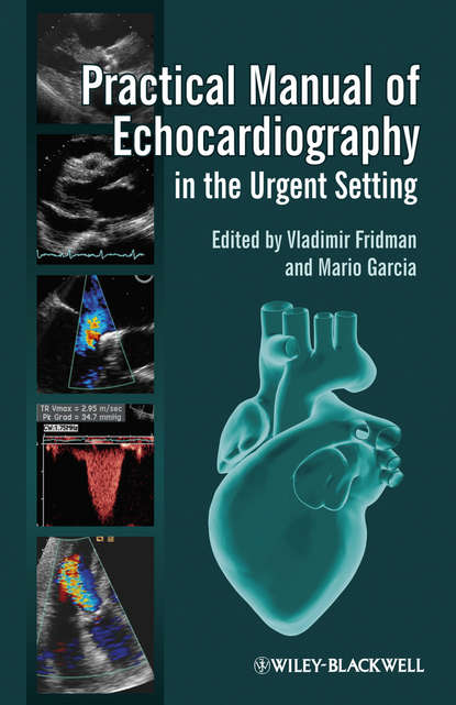 Скачать книгу Practical Manual of Echocardiography in the Urgent Setting