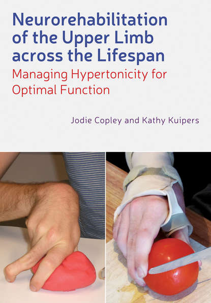 Скачать книгу Neurorehabilitation of the Upper Limb Across the Lifespan. Managing Hypertonicity for Optimal Function