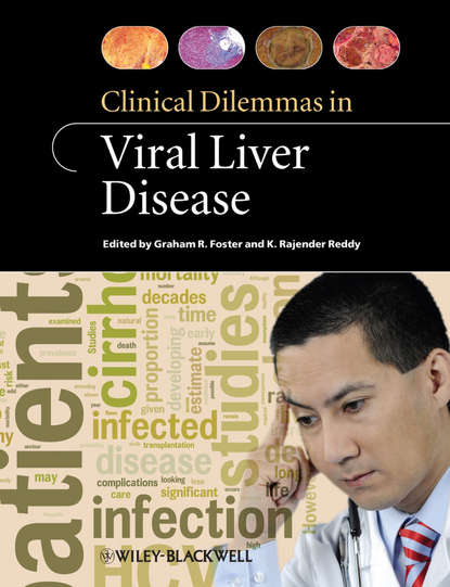 Скачать книгу Clinical Dilemmas in Viral Liver Disease