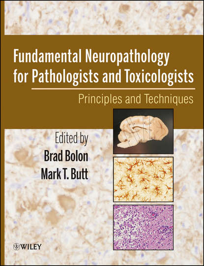 Скачать книгу Fundamental Neuropathology for Pathologists and Toxicologists. Principles and Techniques