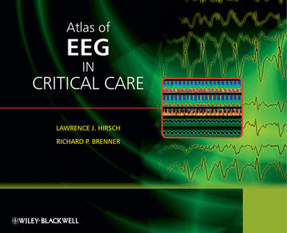 Скачать книгу Atlas of EEG in Critical Care