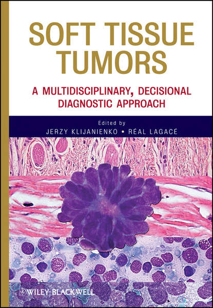 Скачать книгу Soft Tissue Tumors. A Multidisciplinary, Decisional Diagnostic Approach