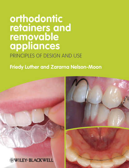 Скачать книгу Orthodontic Retainers and Removable Appliances. Principles of Design and Use