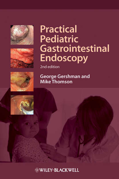 Скачать книгу Practical Pediatric Gastrointestinal Endoscopy