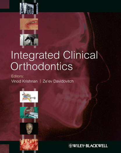 Скачать книгу Integrated Clinical Orthodontics