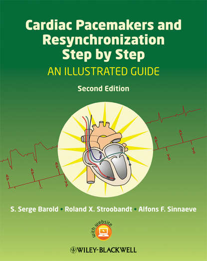 Скачать книгу Cardiac Pacemakers and Resynchronization Step by Step. An Illustrated Guide