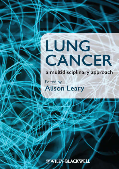 Скачать книгу Lung Cancer. A Multidisciplinary Approach
