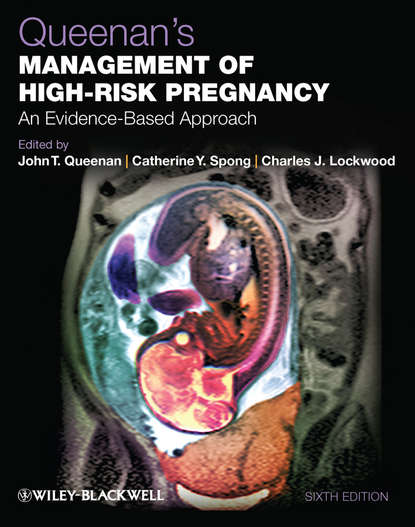 Скачать книгу Queenan's Management of High-Risk Pregnancy. An Evidence-Based Approach