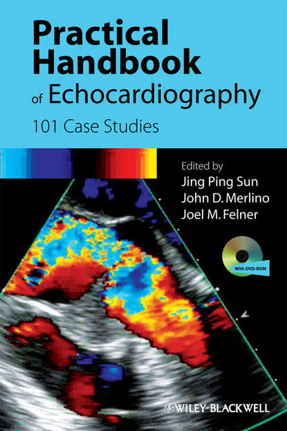 Скачать книгу Practical Handbook of Echocardiography. 101 Case Studies