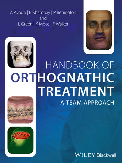 Скачать книгу Handbook of Orthognathic Treatment. A Team Approach