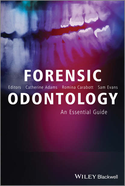 Скачать книгу Forensic Odontology. An Essential Guide