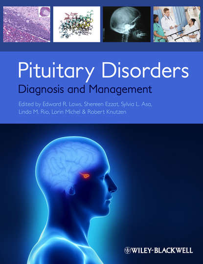 Скачать книгу Pituitary Disorders. Diagnosis and Management