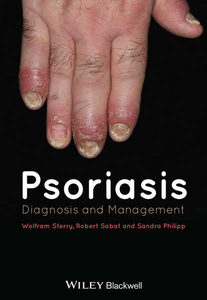 Скачать книгу Psoriasis. Diagnosis and Management