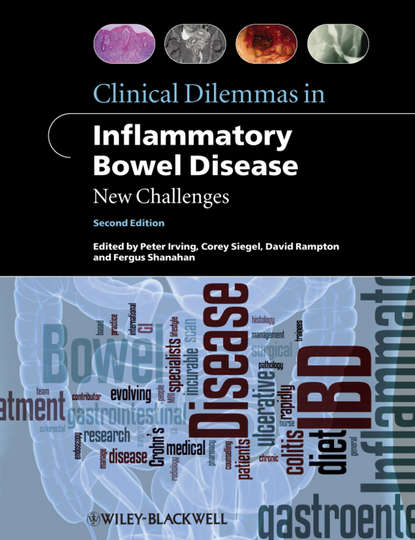 Скачать книгу Clinical Dilemmas in Inflammatory Bowel Disease. New Challenges