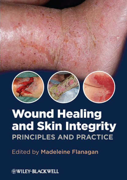 Скачать книгу Wound Healing and Skin Integrity. Principles and Practice