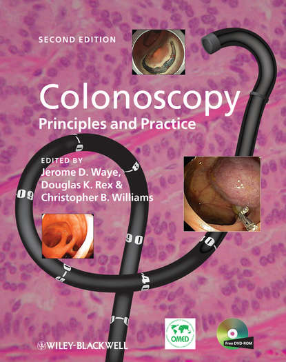 Скачать книгу Colonoscopy. Principles and Practice