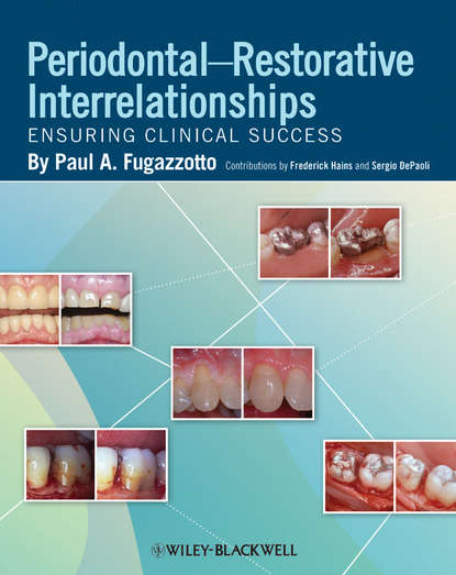 Скачать книгу Periodontal-Restorative Interrelationships. Ensuring Clinical Success