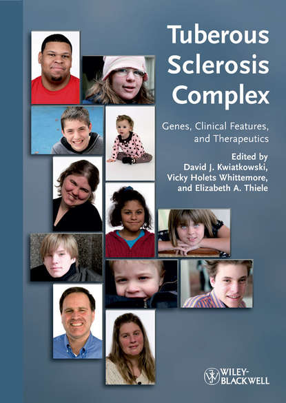 Скачать книгу Tuberous Sclerosis Complex. Genes, Clinical Features and Therapeutics