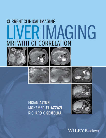 Скачать книгу Liver Imaging. MRI with CT Correlation