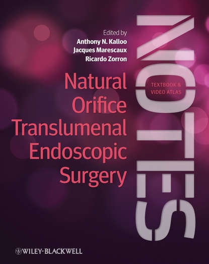 Скачать книгу Natural Orifice Translumenal Endoscopic Surgery. Textbook and Video Atlas