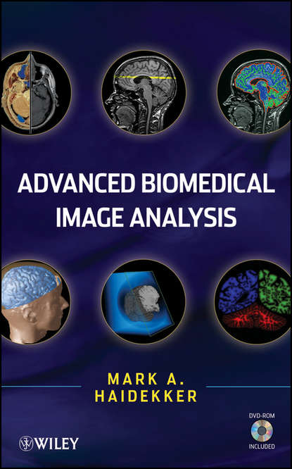 Скачать книгу Advanced Biomedical Image Analysis