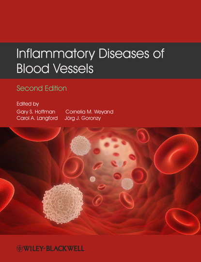 Скачать книгу Inflammatory Diseases of Blood Vessels