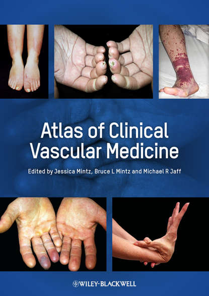 Скачать книгу Atlas of Clinical Vascular Medicine