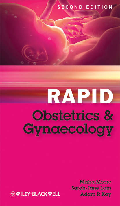 Скачать книгу Rapid Obstetrics and Gynaecology