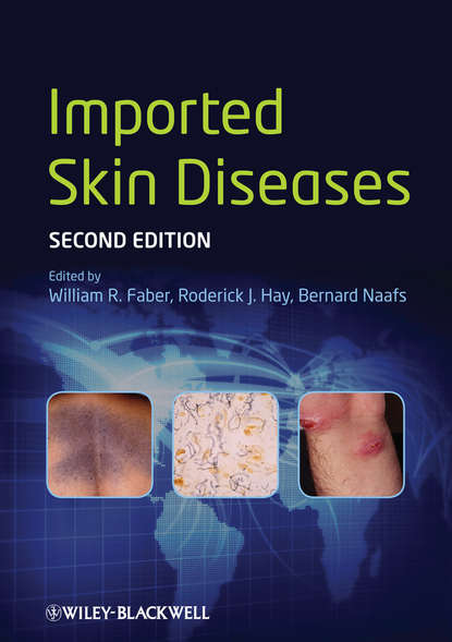 Скачать книгу Imported Skin Diseases