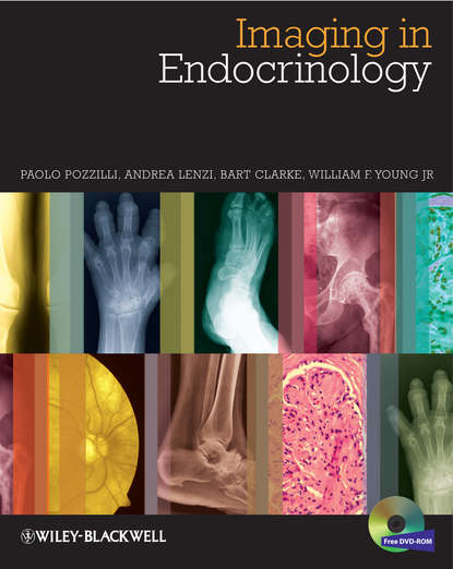 Скачать книгу Imaging in Endocrinology