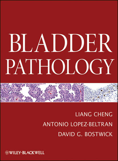Скачать книгу Bladder Pathology