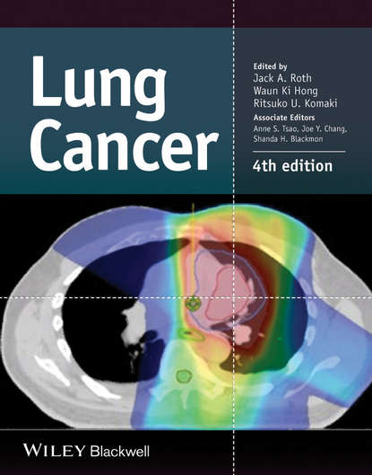 Скачать книгу Lung Cancer