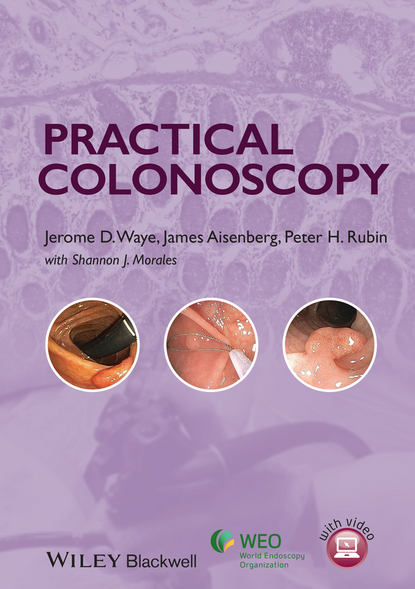 Скачать книгу Practical Colonoscopy