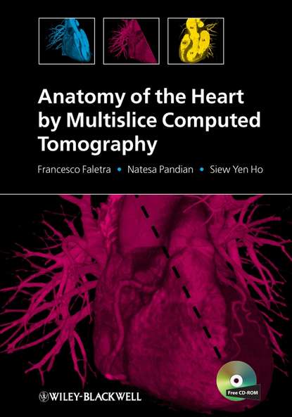 Скачать книгу Anatomy of the Heart by Multislice Computed Tomography