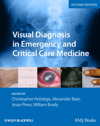Скачать книгу Visual Diagnosis in Emergency and Critical Care Medicine