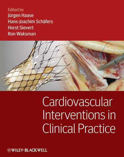 Скачать книгу Cardiovascular Interventions in Clinical Practice