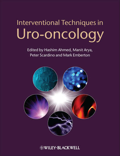 Скачать книгу Interventional Techniques in Uro-oncology
