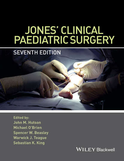 Скачать книгу Jones&apos; Clinical Paediatric Surgery