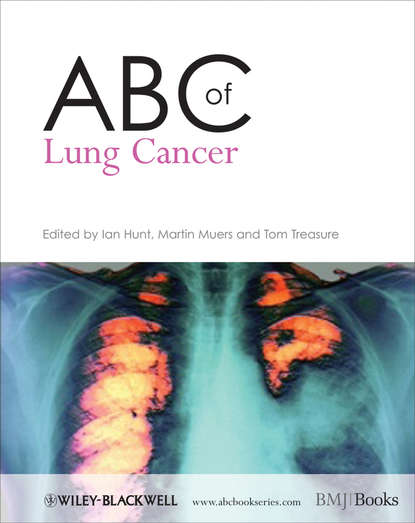 Скачать книгу ABC of Lung Cancer