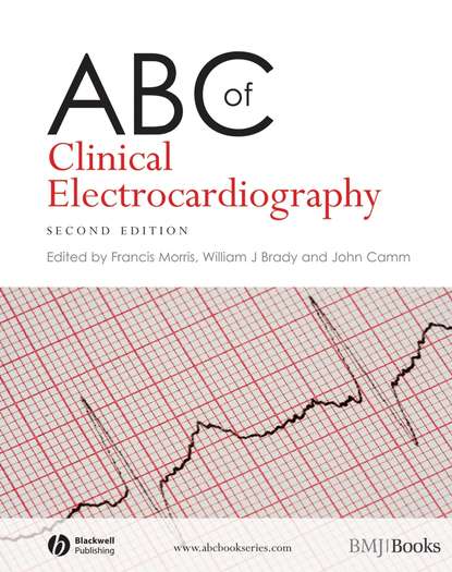 Скачать книгу ABC of Clinical Electrocardiography